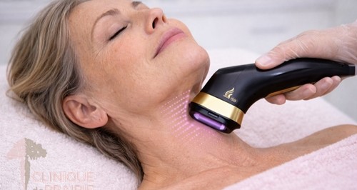 HIFU 13D – Kæbelinje & hals