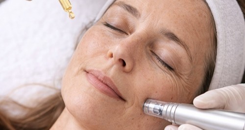 SkinPen med Exosomer